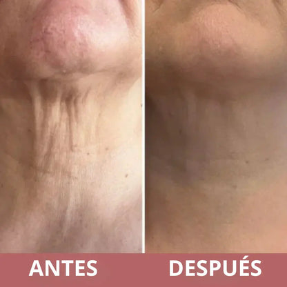MASAJEADOR/Antiarrugas Rodillo 3D Integrado - Específico para cuello y rostro - Tratamiento Antiarrugas \ Jaysuing
